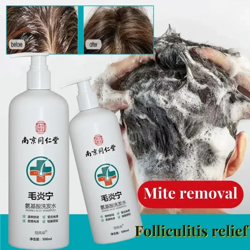 

Improve Frizz Hair Inflammation Amino Acid Ning Shampoo Dew Repair Hair Follicle Plant Mite Removal Hair Cream Damage Repair