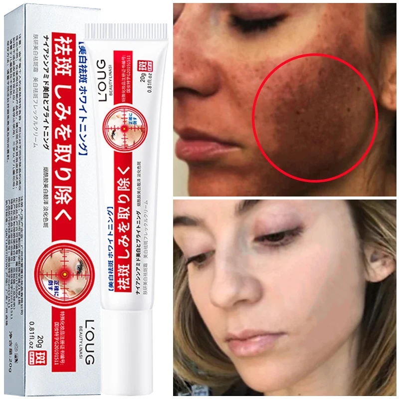 Whitening Freckle Cream Effective Remove Melasma Dark Spots Cream Fade Melanin Moisturize Brighten Smooth Beauty Face Skin Care
Whitening Freckle Cream Effective Remove Melasma Dark Spots Cream Fade Melanin Moisturize Brighten Smooth Beauty Face Skin Care