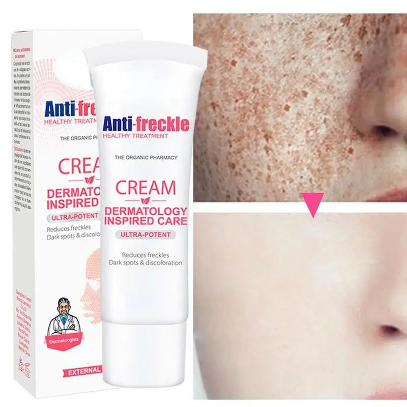Whitening Freckle Cream Remove Dark Spots Melanin Melasma Brighten Face Cream Pigmentation Anti-Aging Skin Care Cosmetics
Whitening Freckle Cream Remove Dark Spots Melanin Melasma Brighten Face Cream Pigmentation Anti-Aging Skin Care Cosmetics