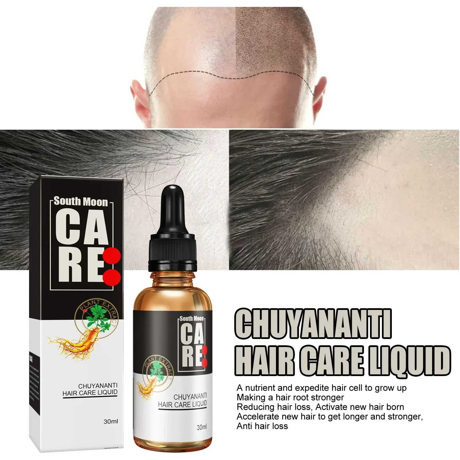 

Sdatter Hair growth solution for preventing hair loss, fixing and densifying hair, magical hairline, hair growth and growth