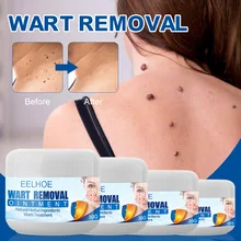 15/25/35/55g Wart Remover Safe Painless Skin Tags Removal Ointment Fast Acting Remover Cream Treatment for All Skins
15/25/35/55g Wart Remover Safe Painless Skin Tags Removal Ointment Fast Acting Remover Cream Treatment for All Skins