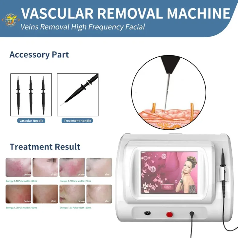 High Frequency Nail Fungus Removal R-F High Frequency For Spider Blood Vessels Removal Blood Vessels Facial Vascular Spider Vein
High Frequency Nail Fungus Removal R-F High Frequency For Spider Blood Vessels Removal Blood Vessels Facial Vascular Spider Vein