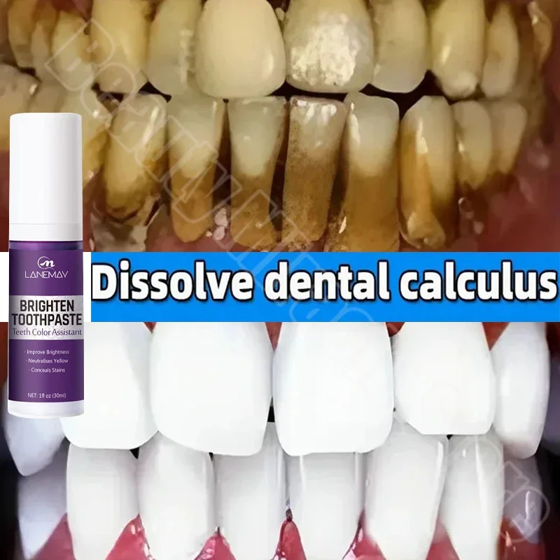 V34 Teeth Whitening Toothpaste Remove Plaque Stains Cleaning Oral Hygiene Bleaching Dental Tools Fresh Breath Dentistry Care
V34 Teeth Whitening Toothpaste Remove Plaque Stains Cleaning Oral Hygiene Bleaching Dental Tools Fresh Breath Dentistry Care