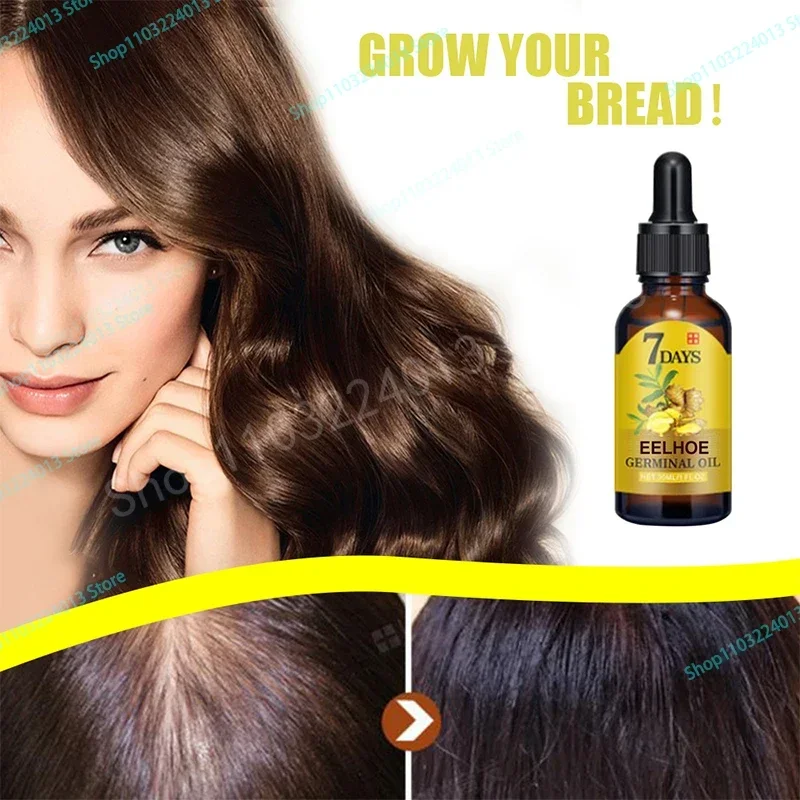 

Имбирный продукт для роста волос Sdatter, сыворотка для восстановления волос против выпадения, масло, средство против облысения, лечение Alopecia для мужчин и женщин
