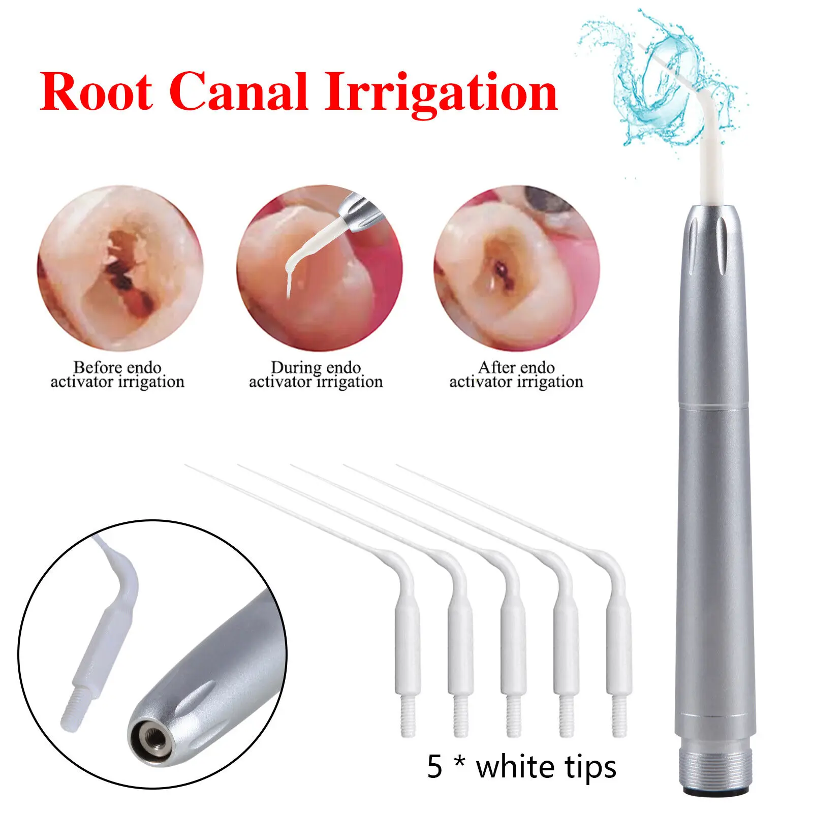 Dental air scaler handpiece Sonic Endo Root Canal Irrigation Tips fit NSK KAVO 2Hole
Dental air scaler handpiece Sonic Endo Root Canal Irrigation Tips fit NSK KAVO 2Hole