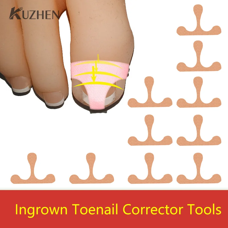 Т-образная коррекция вросших ногтей, антипаронихия, Лечение ногтей, наклейка для педикюра, Ортодонтические ногтевые Пластыри для ногтей
Т-образная коррекция вросших ногтей, антипаронихия, Лечение ногтей, наклейка для педикюра, Ортодонтические ногтевые Пластыри для ногтей