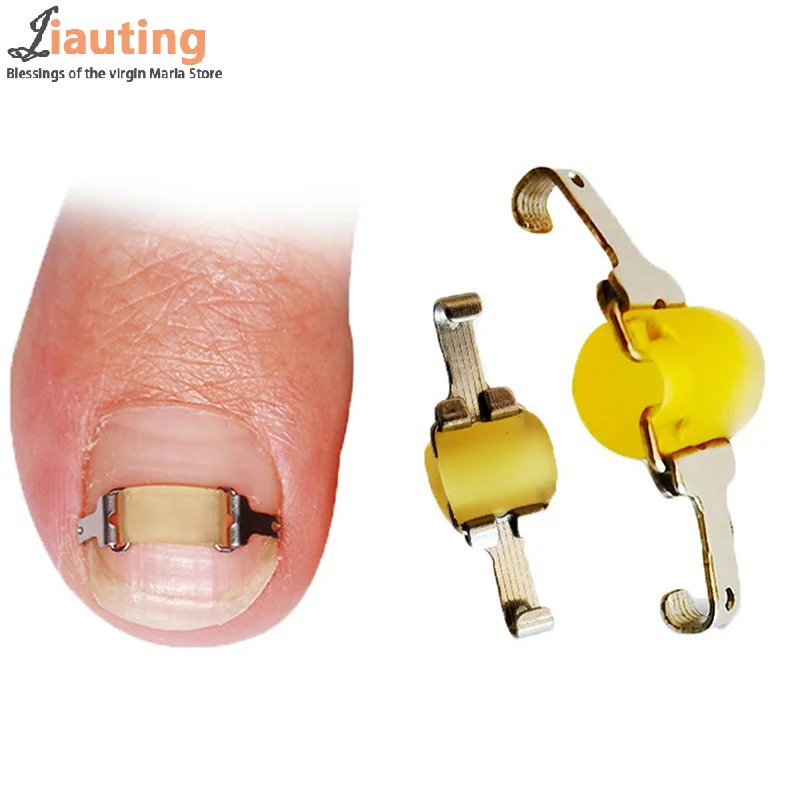 Ingrown Toenail Corrector Tools Recover Embed Toenail Treatment Pedicure Professional Ingrown Toenail Correction Foot Care Tool
Ingrown Toenail Corrector Tools Recover Embed Toenail Treatment Pedicure Professional Ingrown Toenail Correction Foot Care Tool