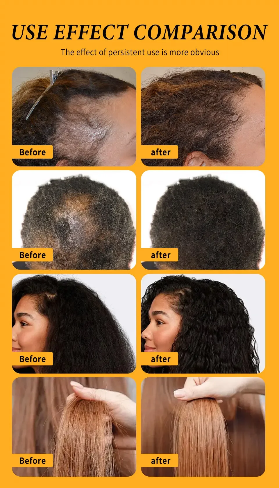Fast Hair Growth Set Batana Oil Traction Alopecia HairS Mask Anti Break Loss Hair Growth Oil Baldness Treatment Hair Health Care 16 Sc1fbe13a40534056acf3c91c1db7e1577