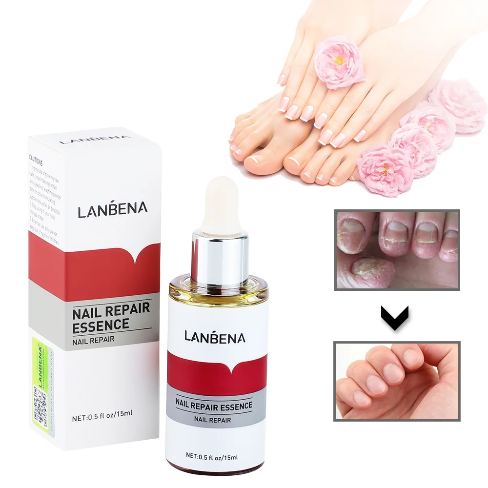 Nail Repair Essence Oil Fungus Removal Serum Anti Infection Paronychia Onychomycosis Toe Nourish Brighten Foot Nail Repair Gel
Nail Repair Essence Oil Fungus Removal Serum Anti Infection Paronychia Onychomycosis Toe Nourish Brighten Foot Nail Repair Gel