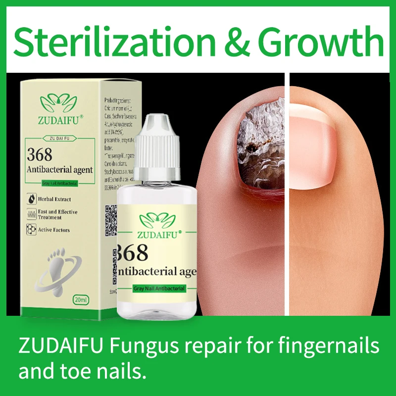Anti-Fungal Repair Solution Remove Onychomycosis Care Thickened Grey Toenails Infection Correction Soft Nail Treatment Liquid
Anti-Fungal Repair Solution Remove Onychomycosis Care Thickened Grey Toenails Infection Correction Soft Nail Treatment Liquid