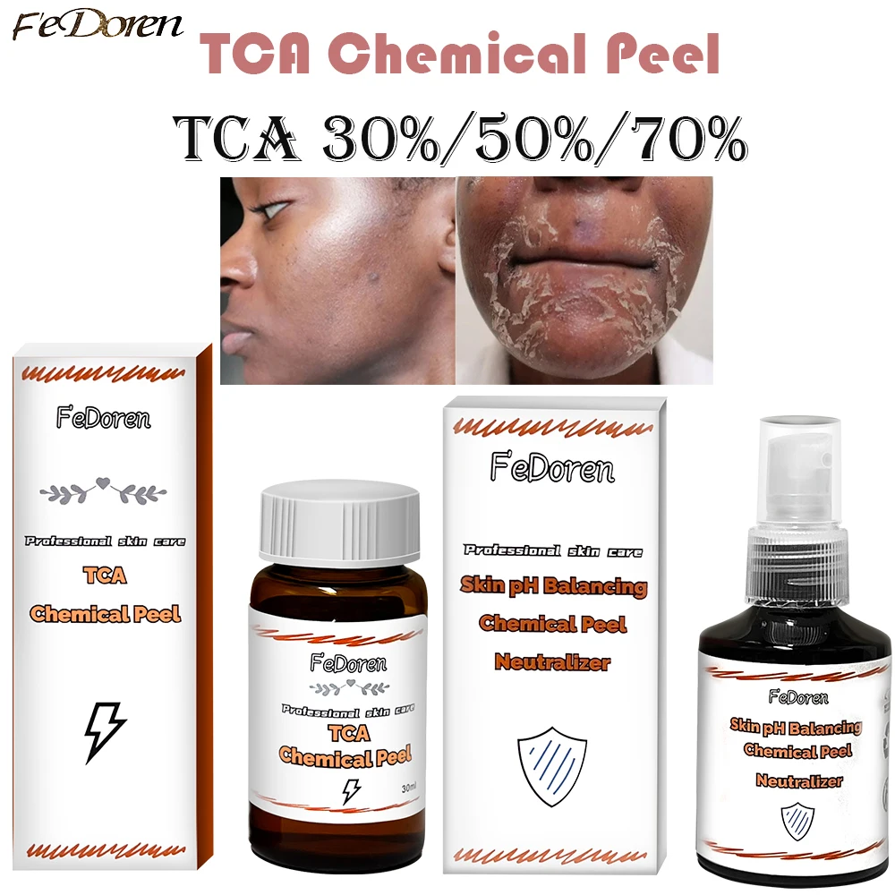 

30ml TCA Chemical Peel 70% Peeling Acid neutralizer set Whitening skin Superforce Peel Pigmentation Acne Scar treatment Serum