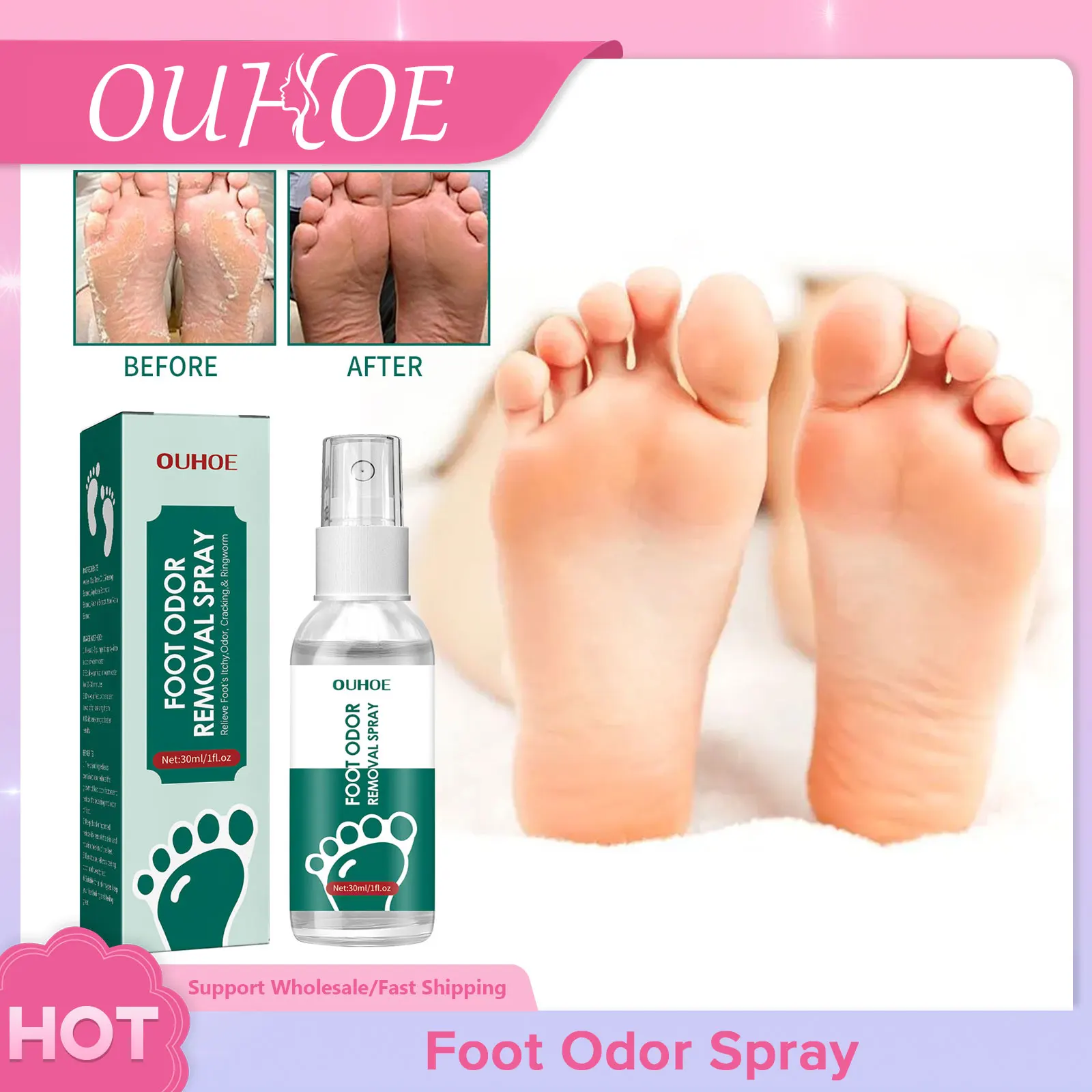 Foot Odor Spray Anti Fungal Onychomyco Sterilization Itch Sweat Odor Remover Crack Chapped Removal Athletes Feet Deodorant Spray
Foot Odor Spray Anti Fungal Onychomyco Sterilization Itch Sweat Odor Remover Crack Chapped Removal Athletes Feet Deodorant Spray