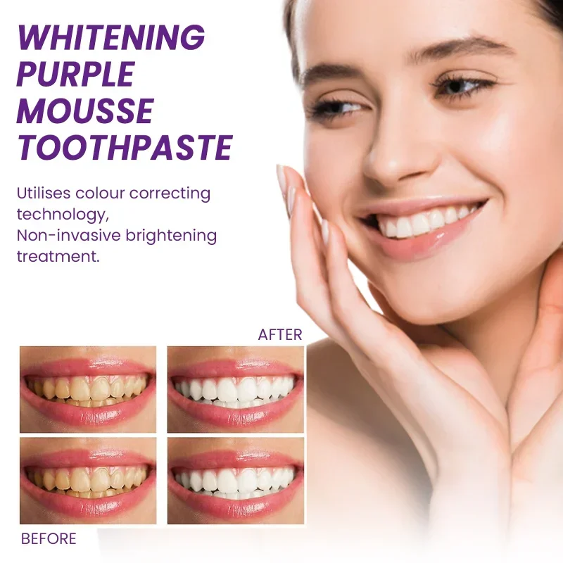 

Sdottor Whitening Purple Mousse Toothpaste Cleaning Yellow Tooth Tartar Remove Cigarette Stains Teeth Anti-Cavity Oral Care Fres