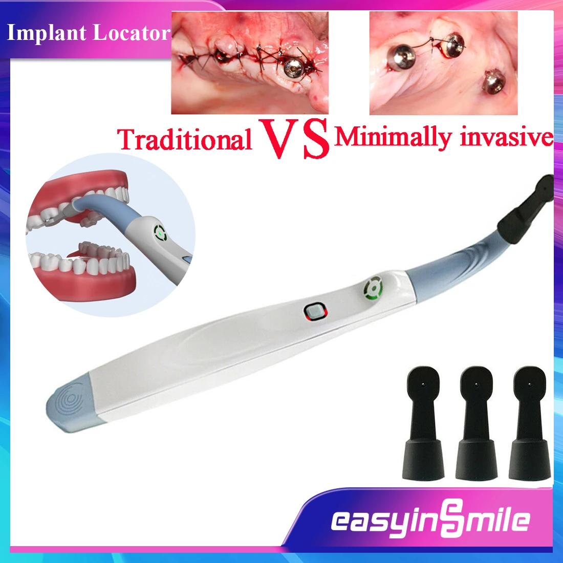 EASYINSMILE Wireless Dental Implant Abutments Locator Detector Smart Rotating 270° Spotting Sensor Motor Contrangle
EASYINSMILE Wireless Dental Implant Abutments Locator Detector Smart Rotating 270° Spotting Sensor Motor Contrangle