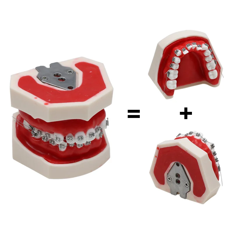 Dental Practice Teeth Model with Braces Orthodontic Model Dentsit Student Learning Model Dental Lab Instrument
Dental Practice Teeth Model with Braces Orthodontic Model Dentsit Student Learning Model Dental Lab Instrument