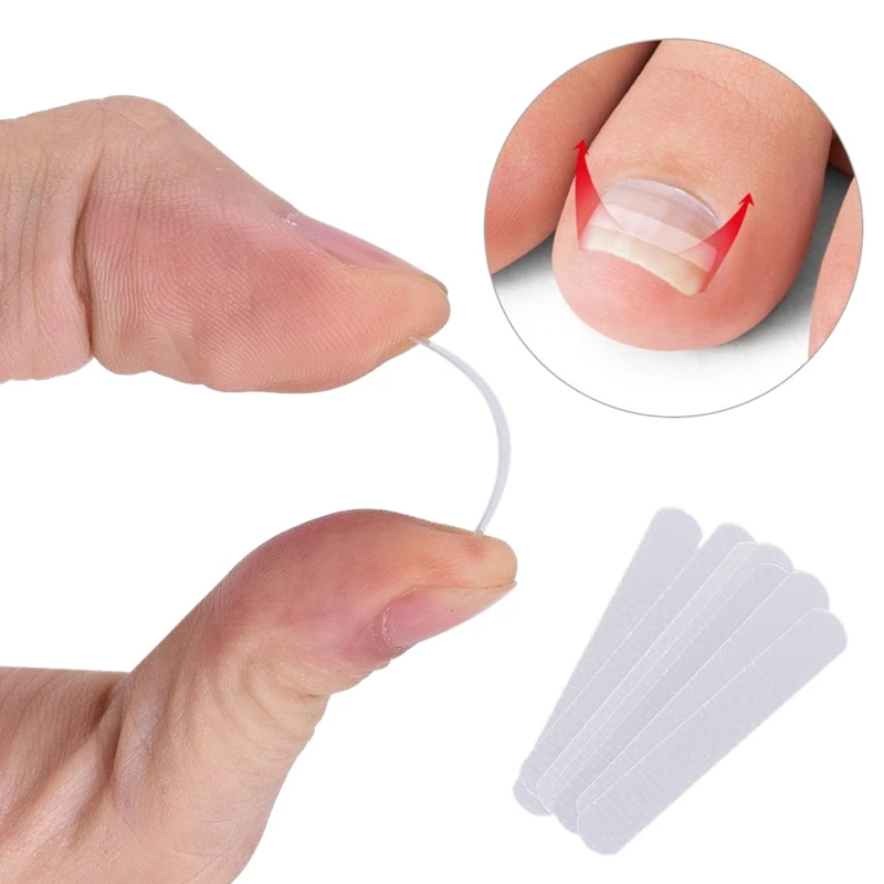 PARON Ingrown Toenail Pedicure Tool 10Pcs/Bottle Straightening Clip Curved Bs Brace Toenails Thick Paronychia Correction Tool Fo
PARON Ingrown Toenail Pedicure Tool 10Pcs/Bottle Straightening Clip Curved Bs Brace Toenails Thick Paronychia Correction Tool Fo