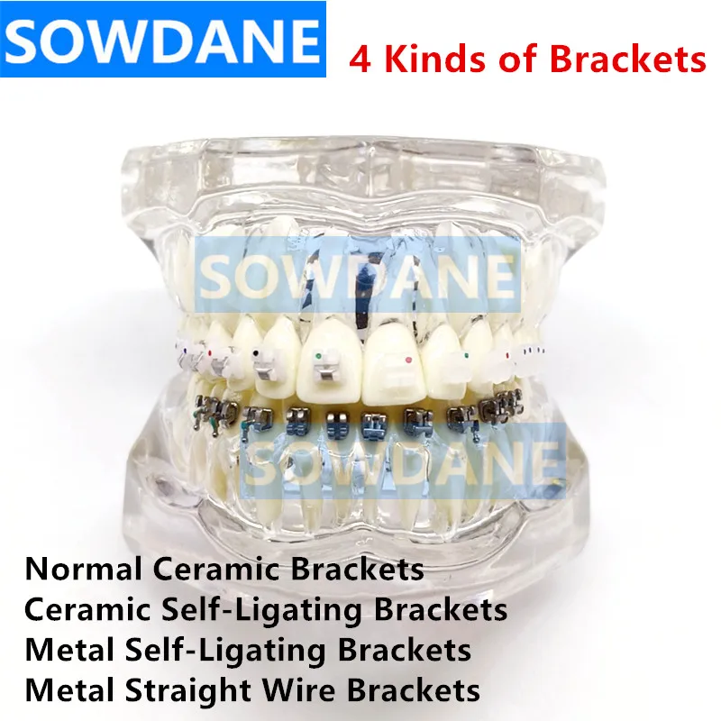 

Dental Orthodontic Model Patients Communication 4 kinds Brackets with Ceramic Self Ligating Bracket Metal Self Ligating Brackets