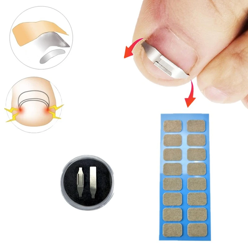 1 комплект, средство для ухода за вросшими ногтями 
1 комплект, средство для ухода за вросшими ногтями