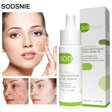 Centella Asiatica Acne Serum Acne Treatment Soothing Repair Remove Acne Marks Blackhead Pigmentation Oligopeptide Skin Care 30ml
Centella Asiatica Acne Serum Acne Treatment Soothing Repair Remove Acne Marks Blackhead Pigmentation Oligopeptide Skin Care 30ml