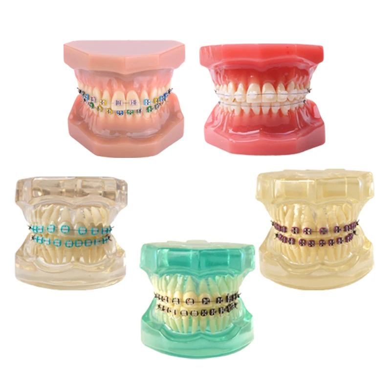 Ortho Metal and Ceramic Model Orthodontic Ceramic Bracket Model Dentist Student Model for Teaching Dental Materials Tools
Ortho Metal and Ceramic Model Orthodontic Ceramic Bracket Model Dentist Student Model for Teaching Dental Materials Tools