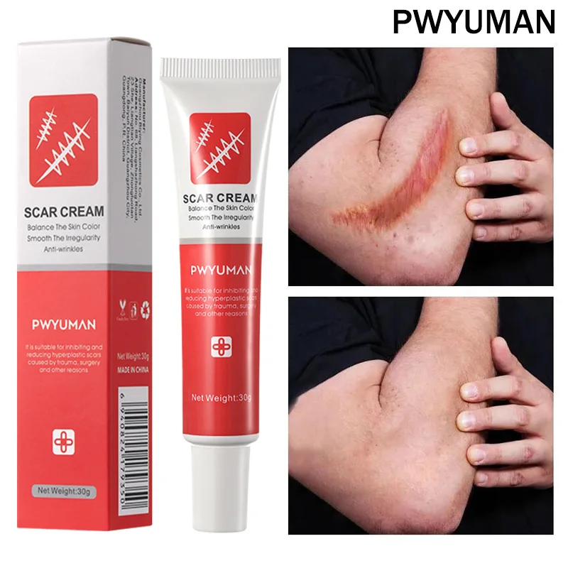 7 Days Scar Removal Cream Burn Surgical Scars Stretch Marks Repair Gel Acne Spots Treatment Whitening Smoothing Body Skin Care
7 Days Scar Removal Cream Burn Surgical Scars Stretch Marks Repair Gel Acne Spots Treatment Whitening Smoothing Body Skin Care