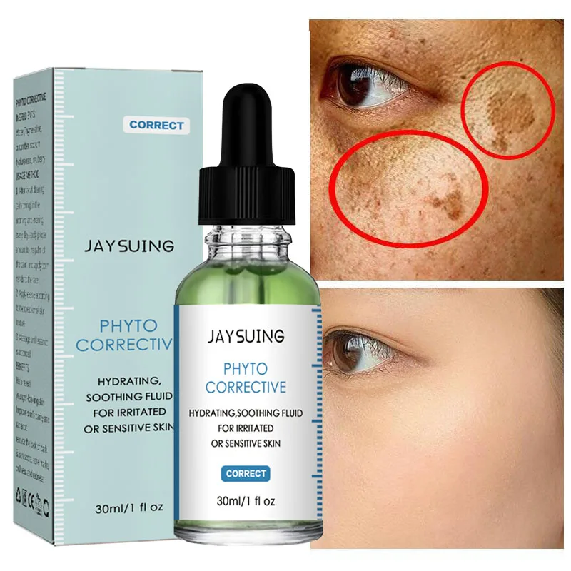 

Whitening Serum Fade Dark Spot Freckle Brighten Essence Remove Pigment Melanin Correcting Beauty Face Skin Care Korea Cosmetic