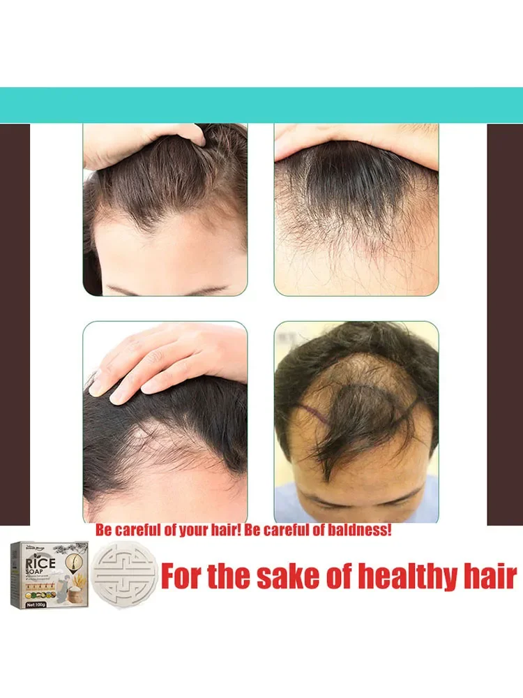 Anti Dropping, Nourishing, Firming,For the sake of hair , Protecting the scalp.Protecting the scalp and Nourishing Hair Roots
Anti Dropping, Nourishing, Firming,For the sake of hair , Protecting the scalp.Protecting the scalp and Nourishing Hair Roots