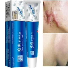 Acne Scar Removal Cream Pimples Stretch Marks Face Gel Remove Acne Smoothing Whitening Body Skin Care Pigmentation Corrector
Acne Scar Removal Cream Pimples Stretch Marks Face Gel Remove Acne Smoothing Whitening Body Skin Care Pigmentation Corrector