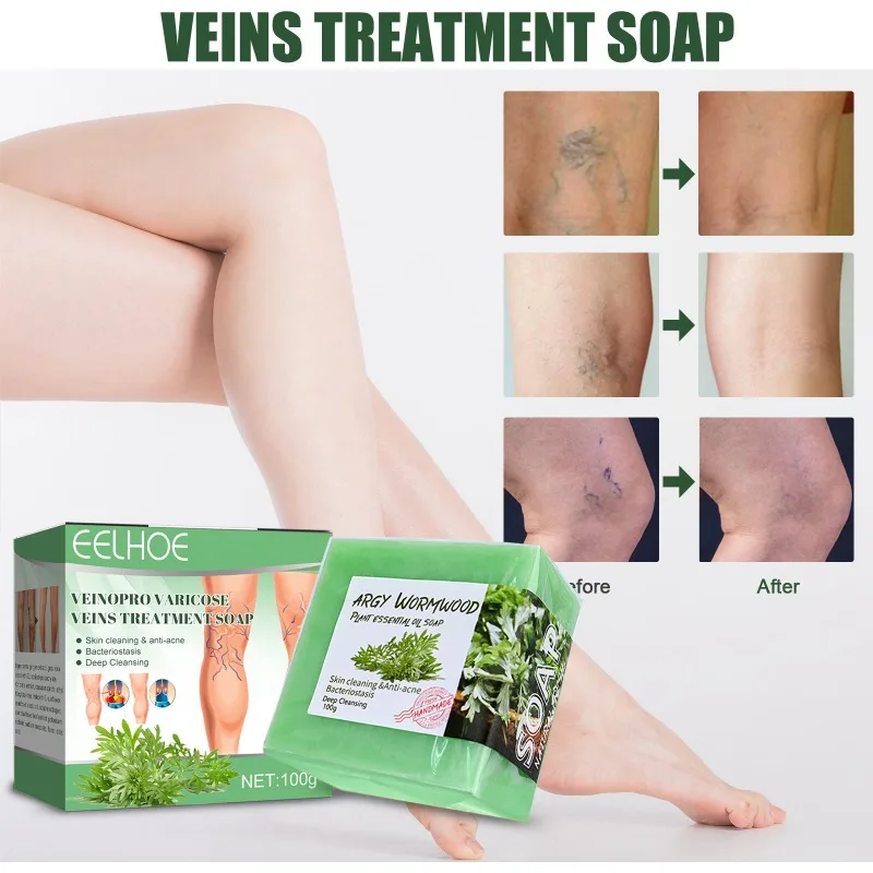 Varicose Veins Treatment Soap Vasculitis Phlebitis Repair Spider Legs Remove Red Blood Improve Circulation cleansing Skin care
Varicose Veins Treatment Soap Vasculitis Phlebitis Repair Spider Legs Remove Red Blood Improve Circulation cleansing Skin care