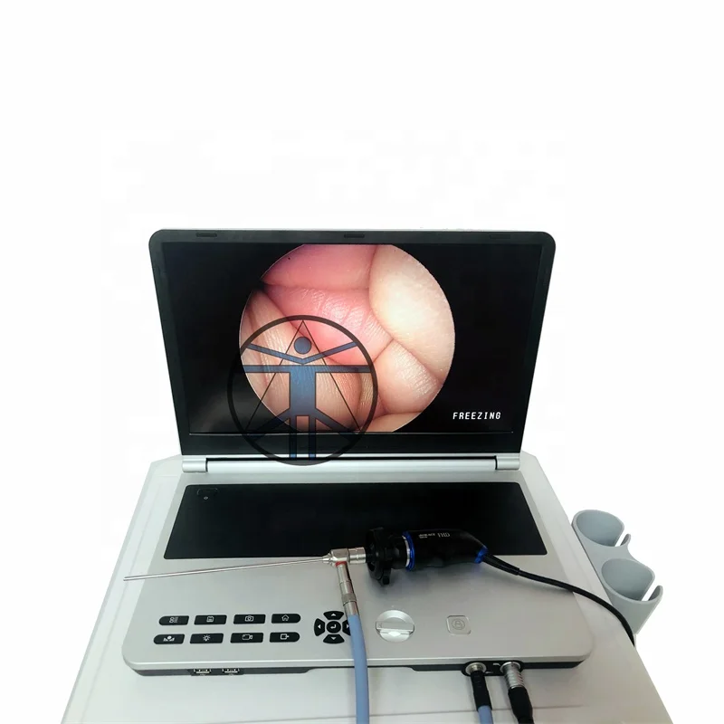 FHD endoscopy camera HD Unit portable endoscope camera for Laparoscopy Hysteroscopy Urology ENT Arthroscopy
FHD endoscopy camera HD Unit portable endoscope camera for Laparoscopy Hysteroscopy Urology ENT Arthroscopy