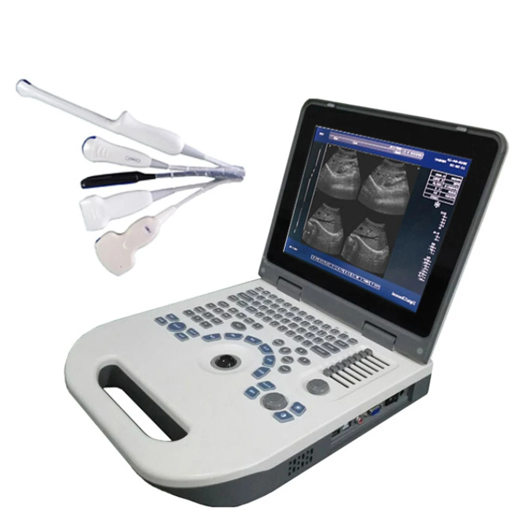 HBW-3P Good Price Hospital Diagnostic Equipment Laptop Escaner Ultrasonido Medical Portable B Ultrasound Machine
HBW-3P Good Price Hospital Diagnostic Equipment Laptop Escaner Ultrasonido Medical Portable B Ultrasound Machine