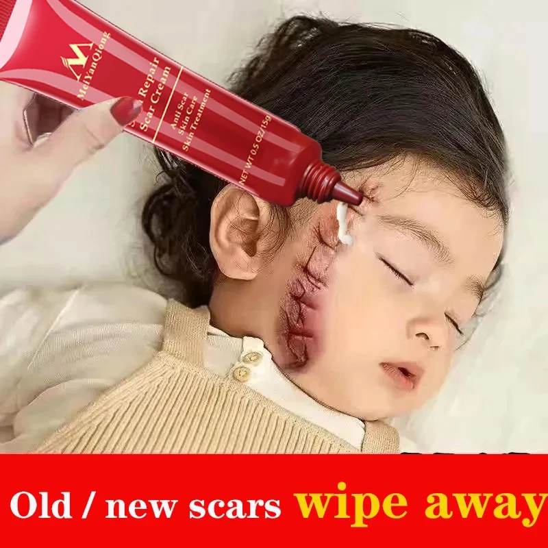 10pcs 15g Natural Scar Remove Ointment Against Black Dots Skin Care Dressing Acne Mask Anti-inflammatory Repair Whitening Cream
10pcs 15g Natural Scar Remove Ointment Against Black Dots Skin Care Dressing Acne Mask Anti-inflammatory Repair Whitening Cream