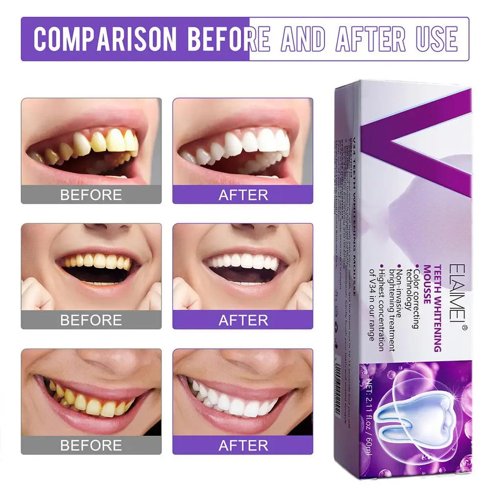 60ml Purple Teeth Whitening Mousse Deep Cleaning Tooth Long-lasting Stains Cigarette Toothpaste Plaque Breath Yellow Fresh Q4W1
60ml Purple Teeth Whitening Mousse Deep Cleaning Tooth Long-lasting Stains Cigarette Toothpaste Plaque Breath Yellow Fresh Q4W1