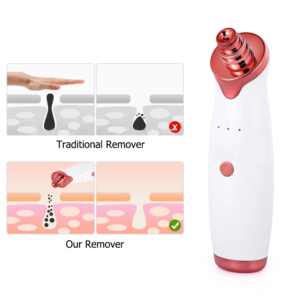 

Blackhead Remover Vacuum Electric Nose Beauty Face Deep Cleansing Skin Care Vacuum Black Spots Acne Pore Cleaner Pimple Tool