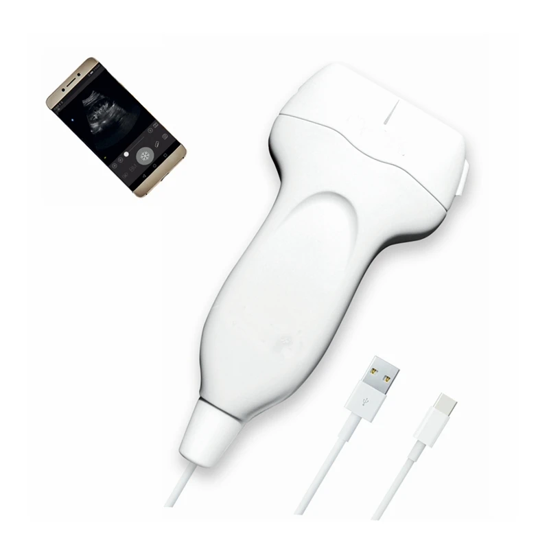 USB ультразвуковой зонд с сенсорным экраном высокого разрешения, портативный черно-белый ультразвук
USB ультразвуковой зонд с сенсорным экраном высокого разрешения, портативный черно-белый ультразвук