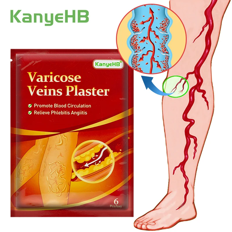

6 шт./1 упаковка, пластырь от варикозного расширения вен