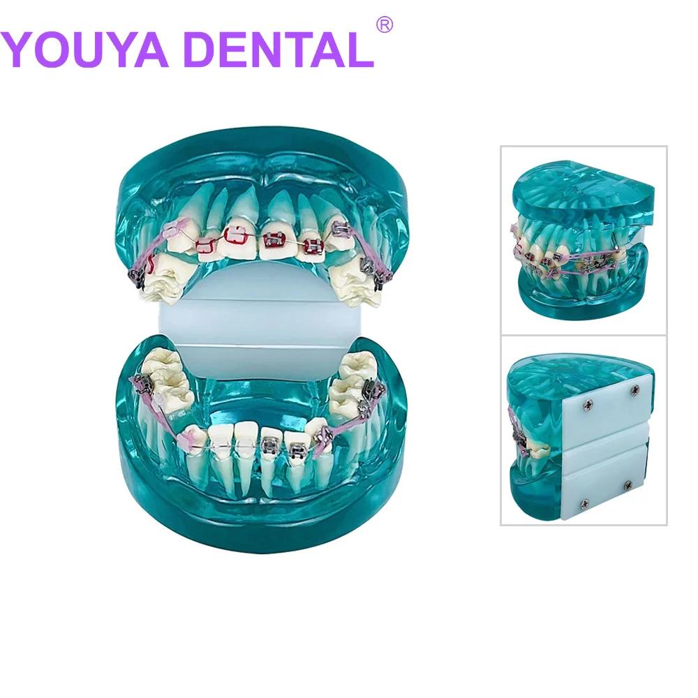 Dental Orthodontic Teeth Model with Braces Half Metal Half Ceramic Dental Standard Teaching Model For Teaching Demonstration Too
Dental Orthodontic Teeth Model with Braces Half Metal Half Ceramic Dental Standard Teaching Model For Teaching Demonstration Too