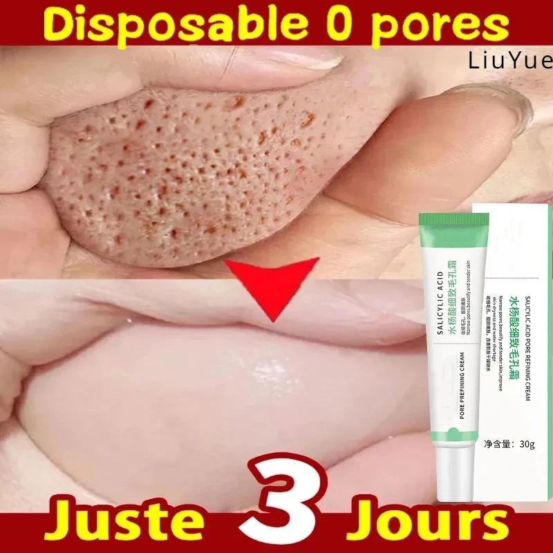 Delicate Po&re Cream Repair Gel Eliminate Improve Nose Melanin Moisturizing Face Moisturizing Skin Brightening Beauty Care Cream
Delicate Po&re Cream Repair Gel Eliminate Improve Nose Melanin Moisturizing Face Moisturizing Skin Brightening Beauty Care Cream