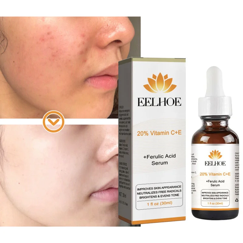 Whitening Removing Spots Vitamin C Serum Improve Dullness Brighten Skin Tone Vitamin E Essence Anti-aging Moisturizing Serum
Whitening Removing Spots Vitamin C Serum Improve Dullness Brighten Skin Tone Vitamin E Essence Anti-aging Moisturizing Serum