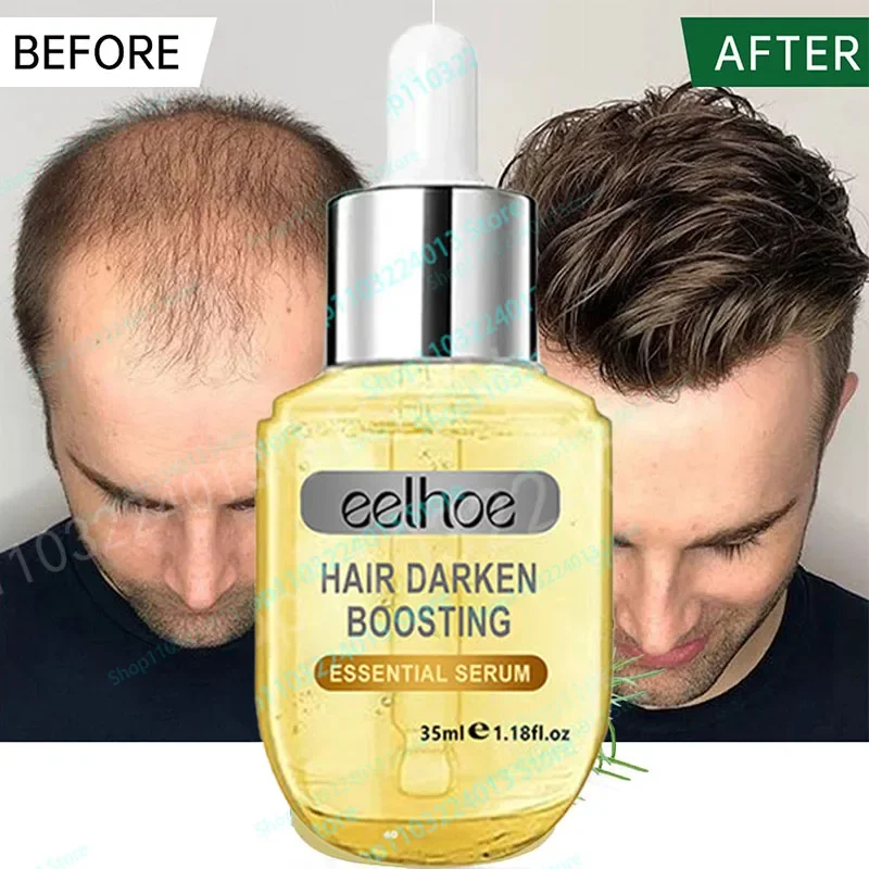 

Hair Growth Essential Oil Biotin Cold-Pressed Hair Growth Shampoo Anti-Hair Loss Conditioner