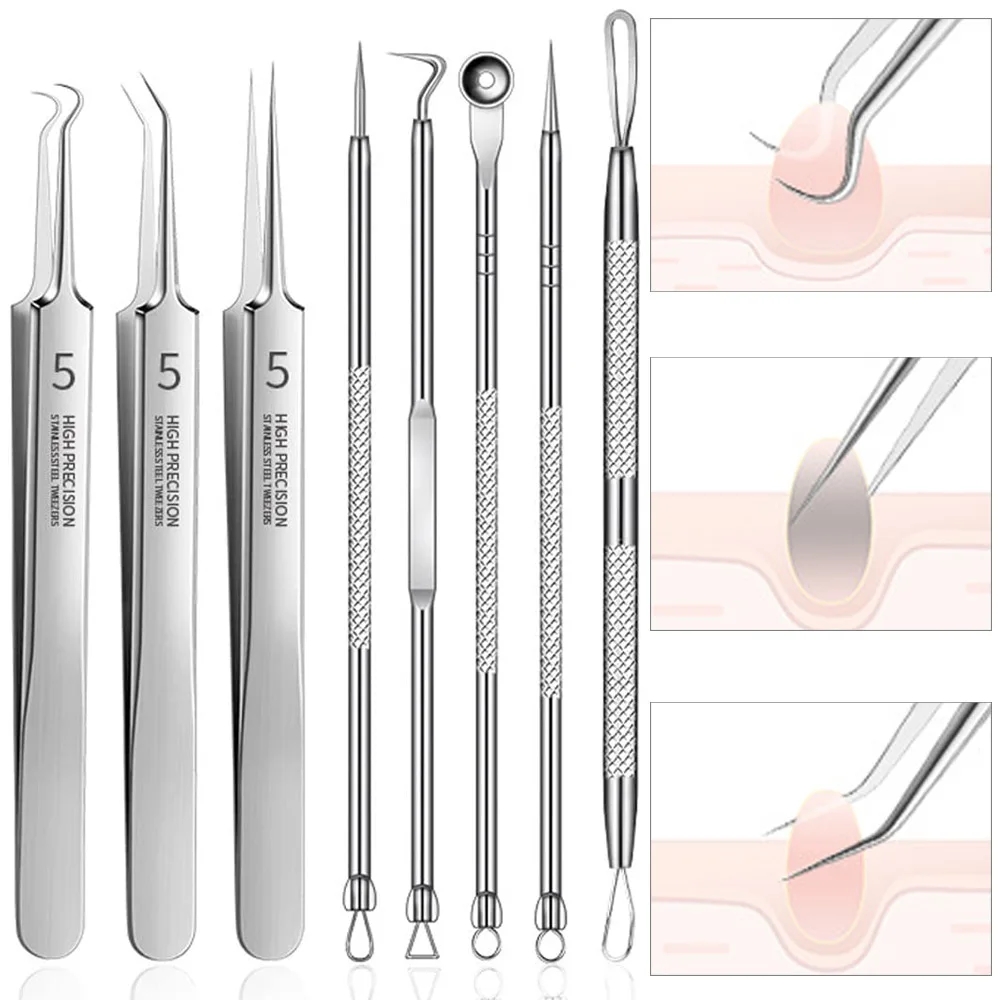1/3/5/8PCS Ultra-fine Pimples Blackhead Clip Tweezers Beauty Face Black Head Cleaner Deep Cleansing Remover Acne Needle Tools
1/3/5/8PCS Ultra-fine Pimples Blackhead Clip Tweezers Beauty Face Black Head Cleaner Deep Cleansing Remover Acne Needle Tools