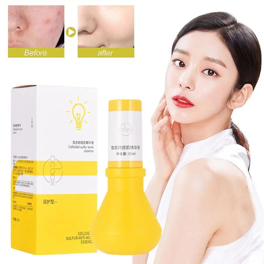 Acne Removing Essence Dispelling Black Marks Blackhead Shrink Removal Skin Tone Smooth Bulb Shape Large Skin Pores Brighten M8J0
Acne Removing Essence Dispelling Black Marks Blackhead Shrink Removal Skin Tone Smooth Bulb Shape Large Skin Pores Brighten M8J0
