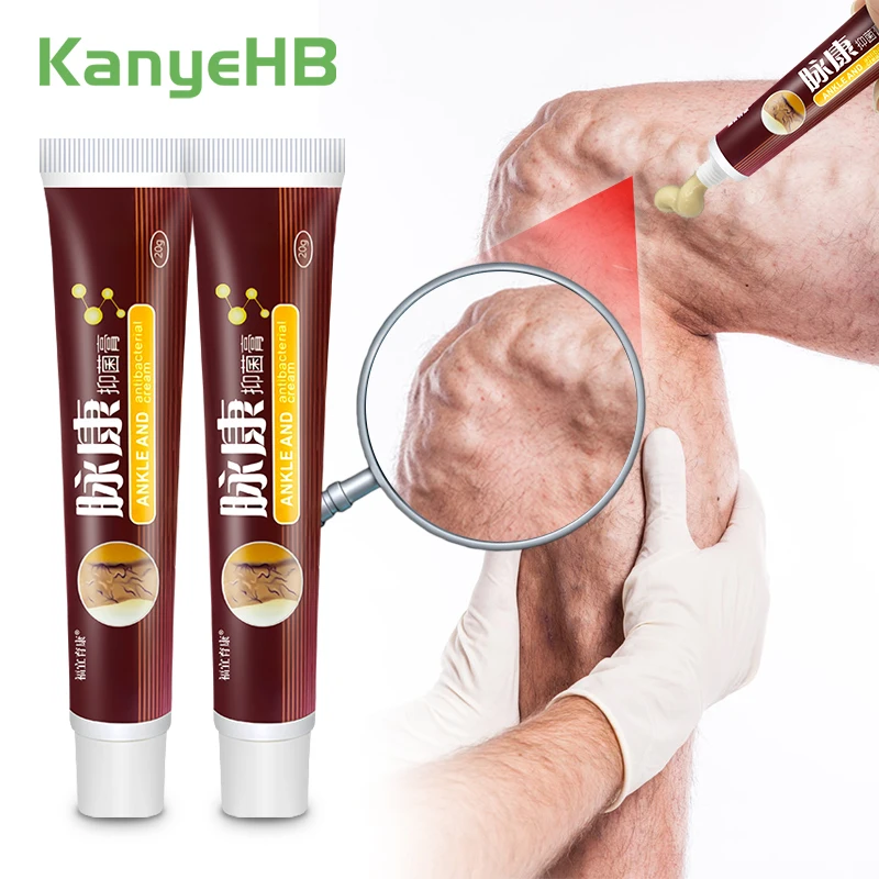 2pcs Leg Varicose Vein Cream Relief Swollen Blood Vessels Spider Shape Vein Treat Ointment Chinese Herbal Medical Plaster A428
2pcs Leg Varicose Vein Cream Relief Swollen Blood Vessels Spider Shape Vein Treat Ointment Chinese Herbal Medical Plaster A428