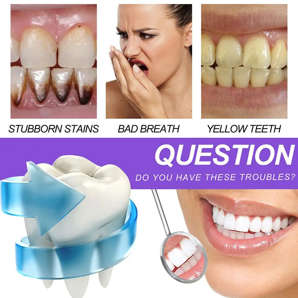 Зубная паста Purple Mousse Dental Beauty, профессиональная яркая зубная паста для свежего дыхания, отбеливания зубов, отбеливания, чистки зубов, белый, желтый, R C4D7
Зубная паста Purple Mousse Dental Beauty, профессиональная яркая зубная паста для свежего дыхания, отбеливания зубов, отбеливания, чистки зубов, белый, желтый, R C4D7