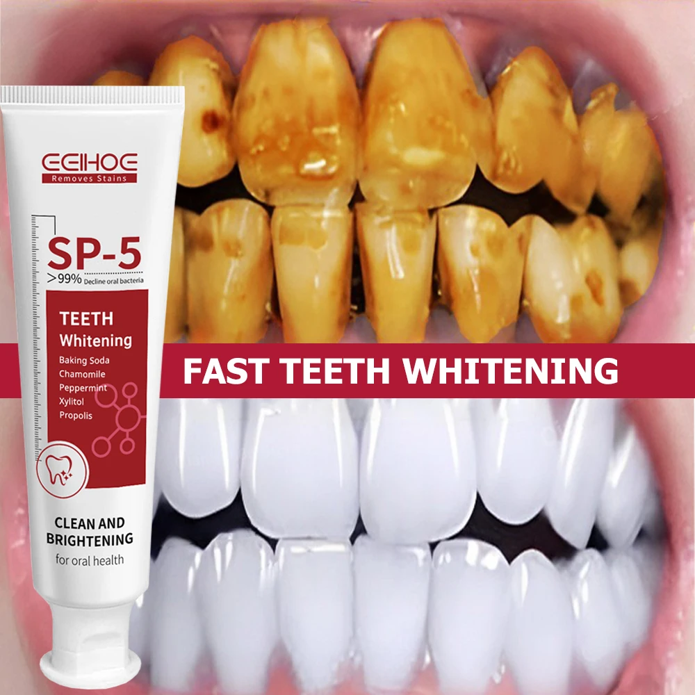 

120g Whitening Teeth Caries SP 5 Toothpaste Gum Tooth Decay Repair Paste Dental Tartar Stain Cleaner Remove Bad Breath Oral Care