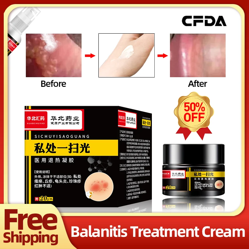 Balanitis Treatment Medicine Cream Apply To Pearl Rash Itching Bacterial Infection Cure 20g/bottle CFDA Approve Glans Spray
Balanitis Treatment Medicine Cream Apply To Pearl Rash Itching Bacterial Infection Cure 20g/bottle CFDA Approve Glans Spray