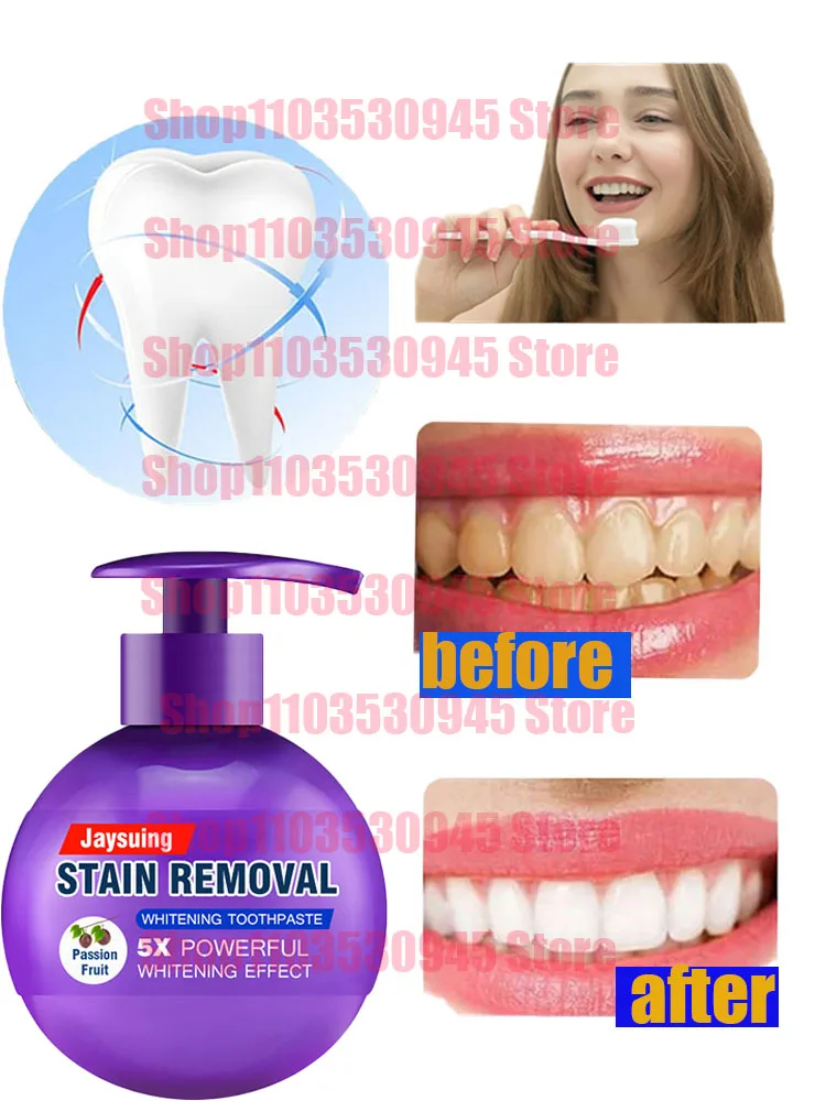 Soda Toothpaste Press Dental Stain Removal Teeth Whitening Gum Repair Oral Care Passion Fruit Blueberry Tooth Paste Squeezer
Soda Toothpaste Press Dental Stain Removal Teeth Whitening Gum Repair Oral Care Passion Fruit Blueberry Tooth Paste Squeezer