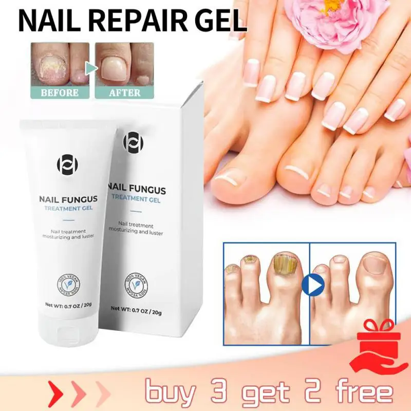 20g Nail Exfoliation Plant Nail Repair Fluid Nail Cream Nail Treatment Gel Nail Repair Gel Moisturizing Nail Luster Treatments
20g Nail Exfoliation Plant Nail Repair Fluid Nail Cream Nail Treatment Gel Nail Repair Gel Moisturizing Nail Luster Treatments