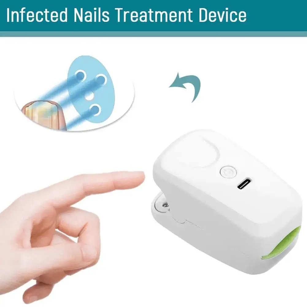 Mini Nail Fungus Laser Treatment Device USB Fingernails Toenails Onychomycosis Therapy Cure Machine Unisex Foot Care Tools
Mini Nail Fungus Laser Treatment Device USB Fingernails Toenails Onychomycosis Therapy Cure Machine Unisex Foot Care Tools