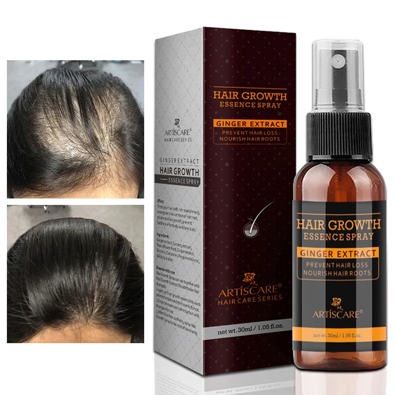 Ginger Herbal Hair Growth Serum Spray Effective Fast Anti-Hair Loss Regenerating Liquid Hair Thinning Treatment Scalp Care 30ml
Ginger Herbal Hair Growth Serum Spray Effective Fast Anti-Hair Loss Regenerating Liquid Hair Thinning Treatment Scalp Care 30ml